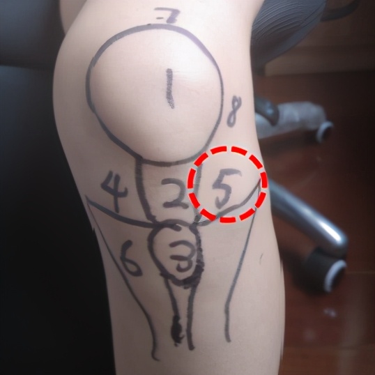 不同膝盖疼痛是暗示什么,不同位置的膝盖疼