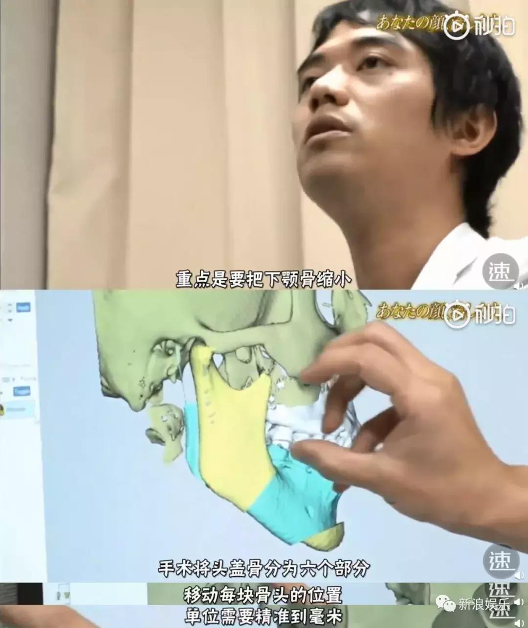 那些整容脸真的觉得自己好看吗,为什么整容以后都是一样的网红脸