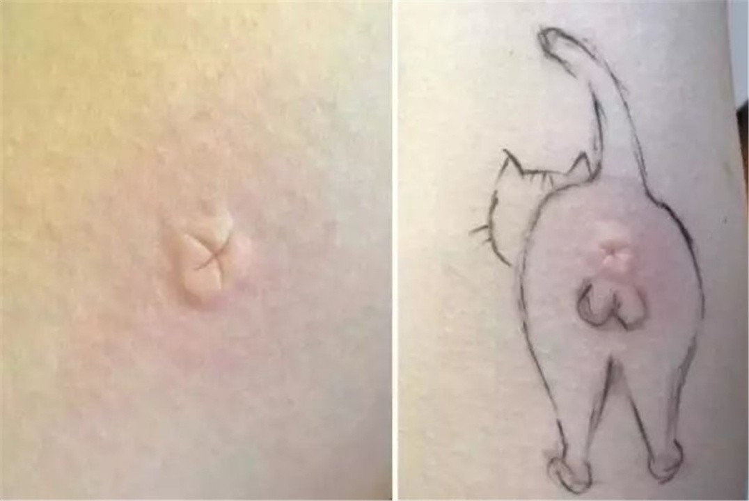 痒是什么原因引起,痒是为啥