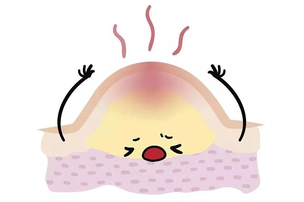 脸上泛红可以用含酒精的护肤品吗,护肤品里都含有美容酒精吗