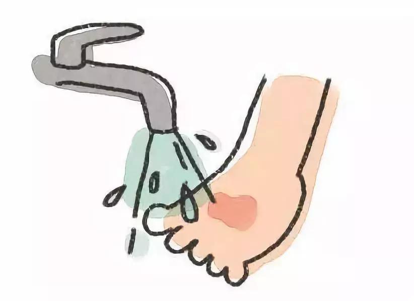 小孩被热水烫伤了该怎么处理,孩子不小心被开水烫伤怎么办