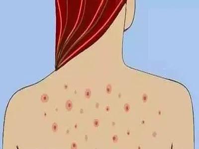 这里的毛毛千万别乱拔！小心会有生命危险