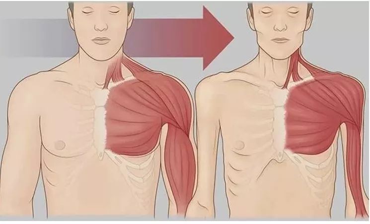 这几种方法可以减少HIV感染引起的四肢消瘦