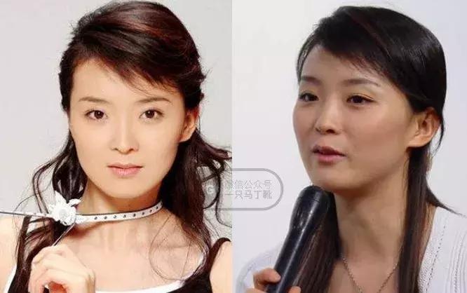 颧骨为什么不能美成俞飞鸿,俞飞鸿颧骨抗老