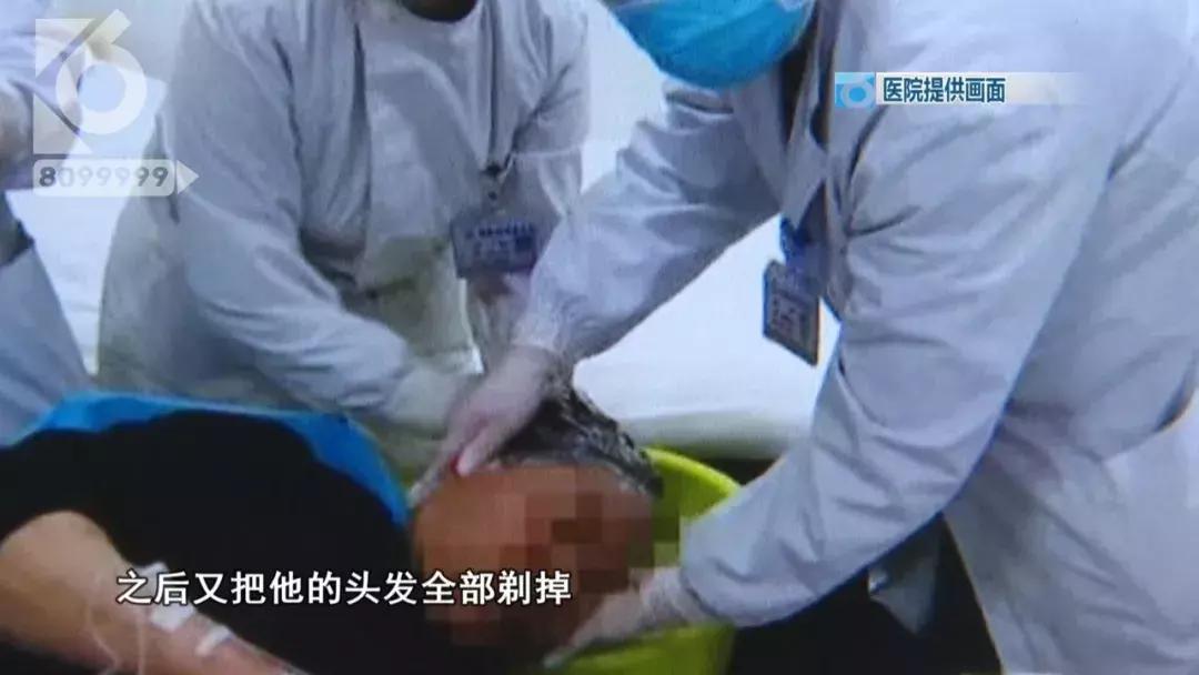 敌敌畏中毒解救,敌敌畏洗头中毒几天能痊愈