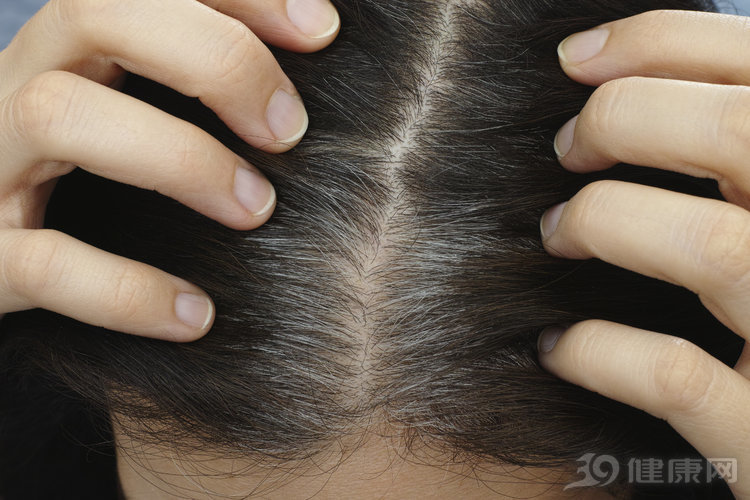 这几种方法让你摆脱白发困扰,如何让白发变黑的方法如下