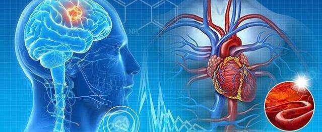 怎么预防尿晕症,晕尿症需要治疗吗