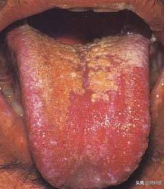 最实用的舌诊图六大舌象,舌诊深入学习书