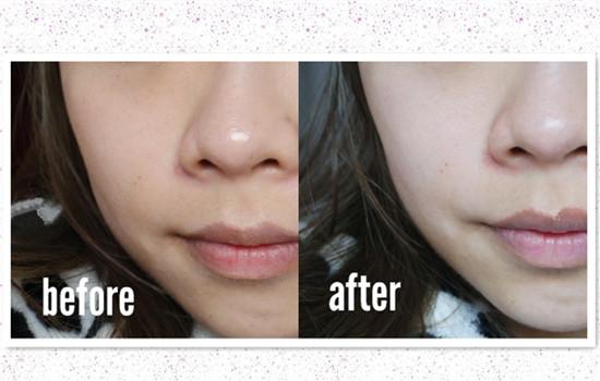 兰蔻小黑瓶好还是雅诗兰黛棕瓶好,兰蔻小黑瓶和雅诗兰黛棕瓶怎么选