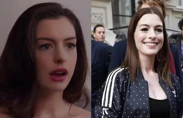 治眼袋皱纹最好的软膏,28岁的女生小细纹用什么抗衰祛皱