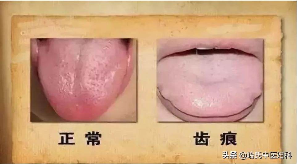 习惯性流产怎么样才能保胎河南,习惯性流产保胎最好的方法