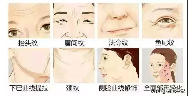 28岁做线雕提升脸部好不好,28岁女人做线雕现状