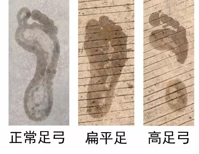 业余跑者怎么选鞋,入门跑者长跑鞋怎么选