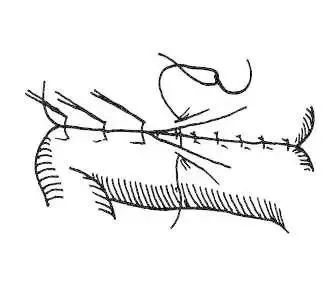 外科缝合方法笔记,兽医外科手术中最常用的缝合方法