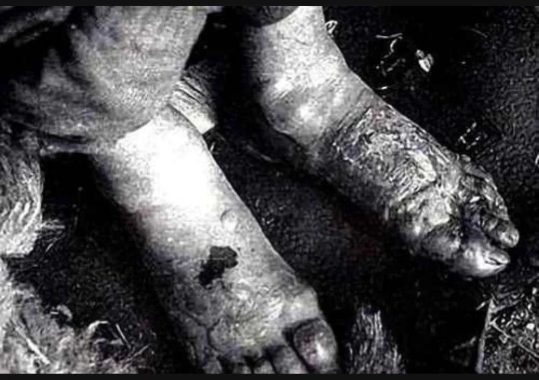 日军731老兵：实验疼痛度我想起都怕。活人冻伤实验有多残忍？