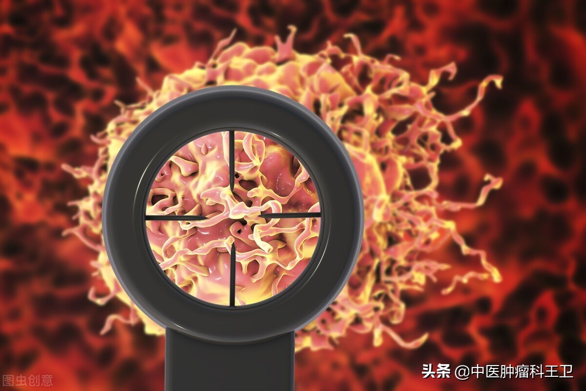 中医食疗治疗前列腺癌,前列腺癌吃参丹散结胶囊