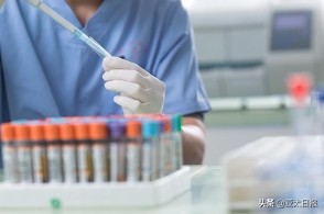 投桃报李！日本新冠疫情告急，中国援助核酸试剂