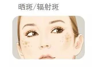 再美的脸,也抵挡不住“加斑”的困扰