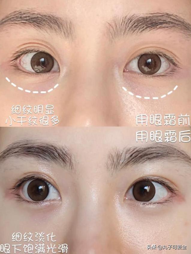 去眼纹的药膏有哪几种,38岁开始有眼纹怎么办