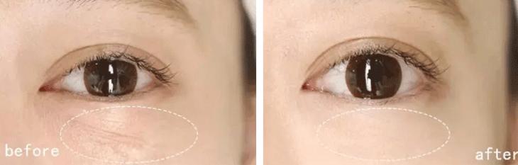 玻尿酸睡眠眼罩,日本去黑眼圈最好的产品