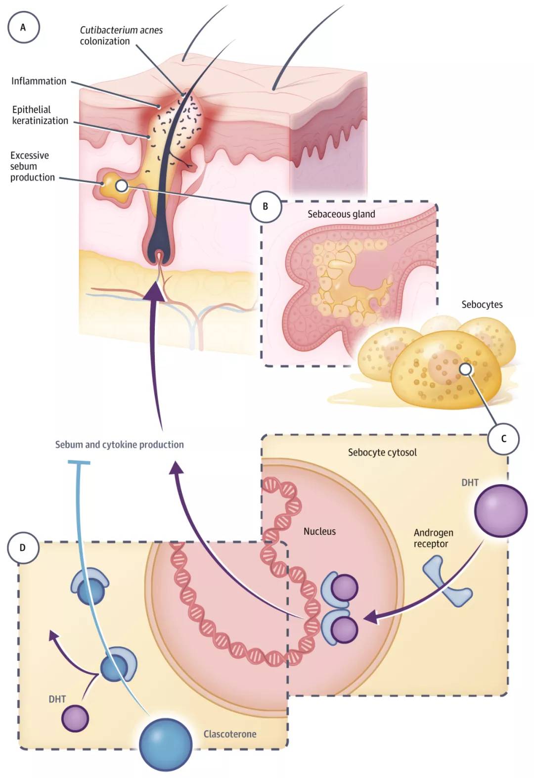 fda首款青春痘药物,fda青少年抗抑郁治疗