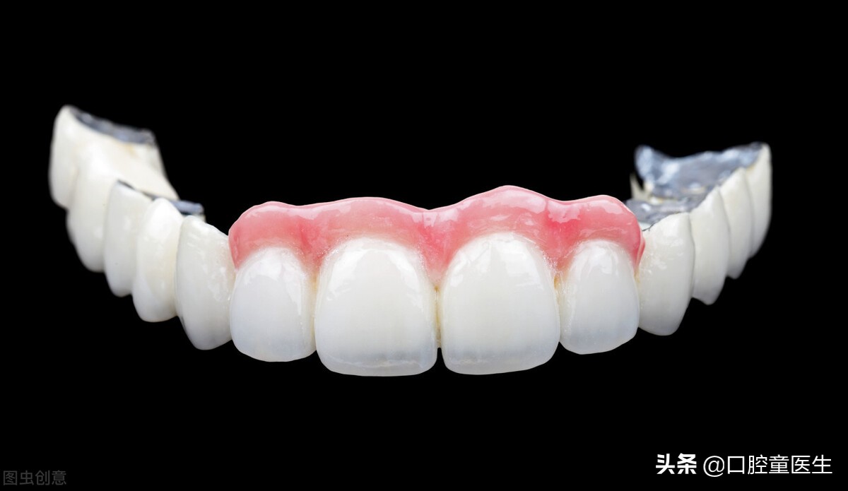 烤瓷牙属于永久修复吗,烤瓷牙有不变黑的吗