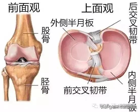 内侧半月板后角损伤怎么治疗,半月板损伤有积液的最好治疗