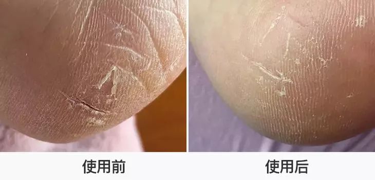 王子文拍照姿势,王子文惊艳泼辣写真