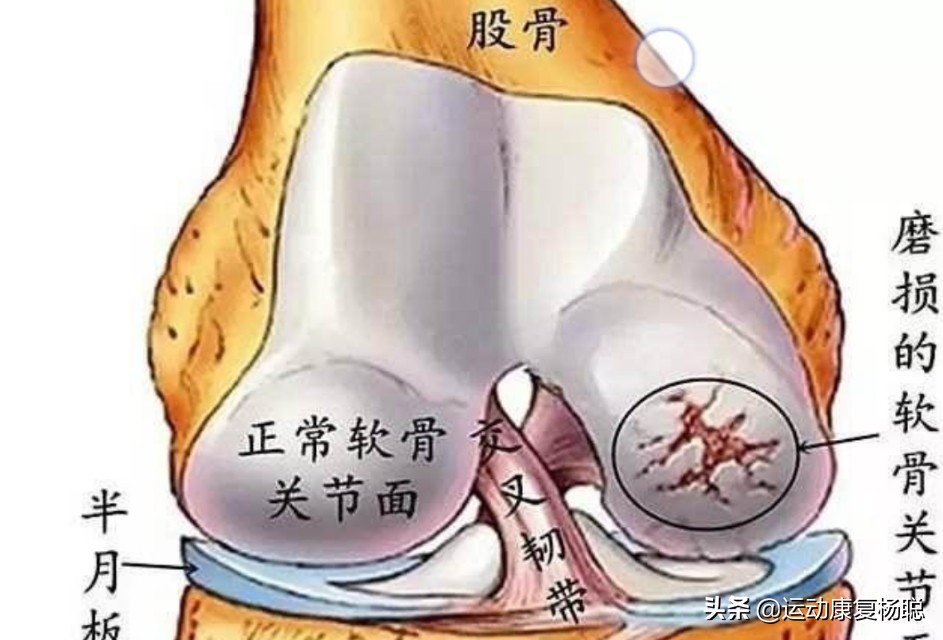 膝关节疼痛分类,膝关节疼痛是什么症状