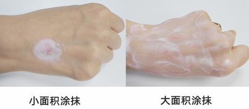 皮肤发痒抹炉甘石就好什么原因,皮肤痒擦炉甘石有用吗