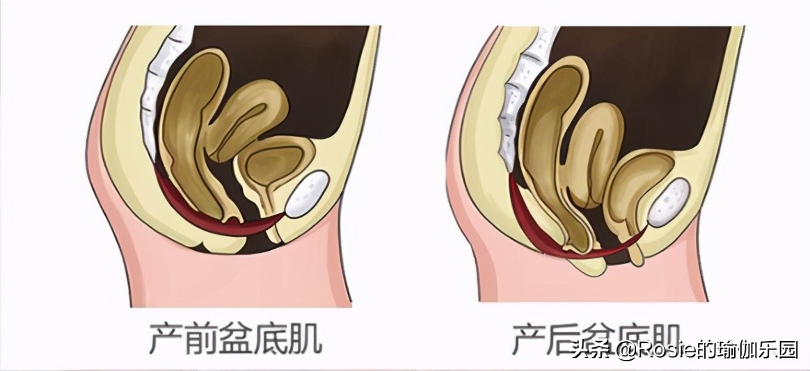 眼馋陈卓璇巴掌腰,竟靠束腰勒小腰?做对一个动作一周瘦出小蛮腰