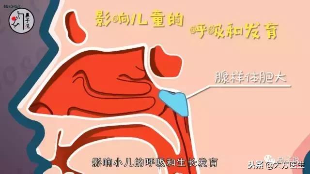 详细看一下鼻子的结构,从鼻孔形状能看出鼻子高低吗