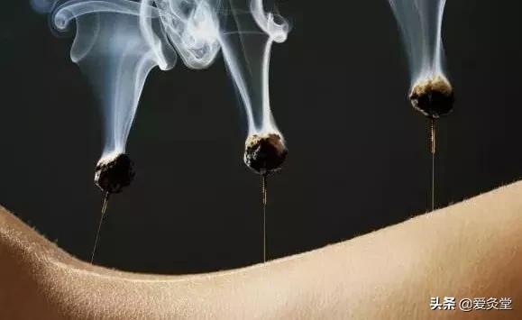 夏天艾灸好还是冬天艾灸好,春天艾灸好还是夏天艾灸好