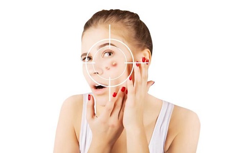 祛痘品牌排行榜十强,祛痘品牌店排行榜十强有哪些