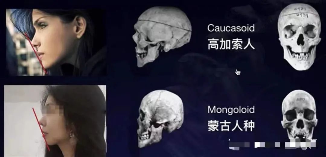 9块9隐形牙套,在家自制透明牙套