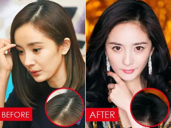 张歆艺防止妊娠纹,张歆艺预防妊娠纹