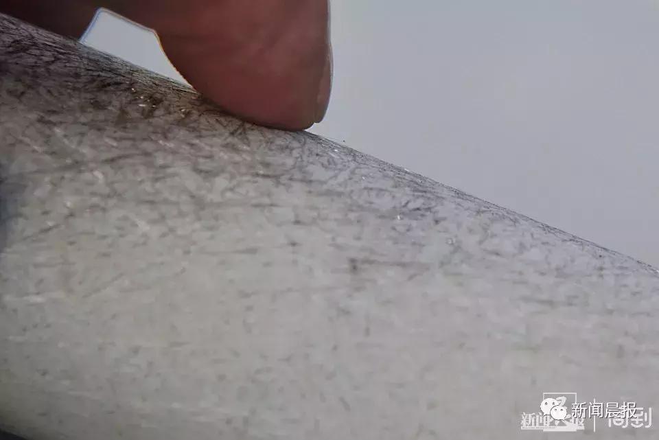 3岁女孩被扶梯咬住手,3岁女童乘客扶梯右脚被咬