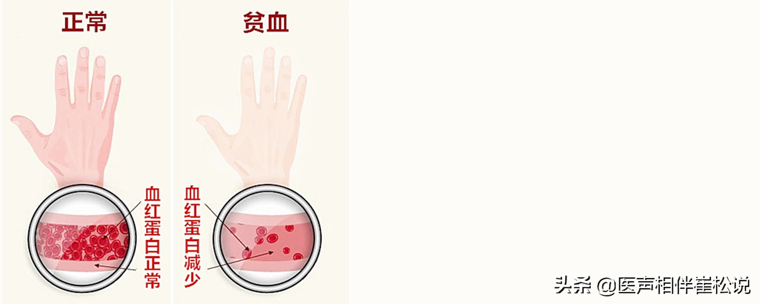 心电图上t波改变啥意思,心电图上t波改变