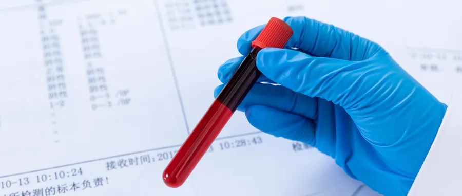 超敏c反应蛋白高应该怎么办,超敏c反应蛋白30多严重么