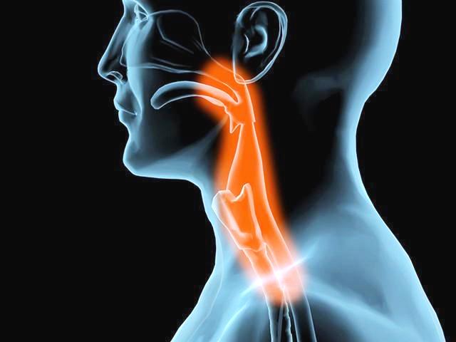 咽异物感,咽痒有异物感引起咳嗽吃什么药好