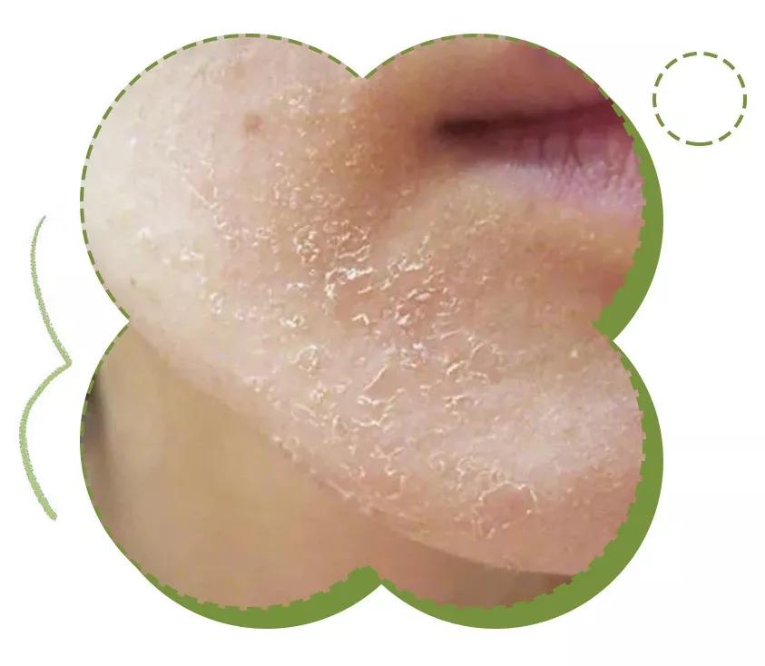 9.9元绵羊油保湿霜,绵羊油8.8元三盒