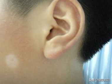 健康科普馆设备,武医生治疗白癜风