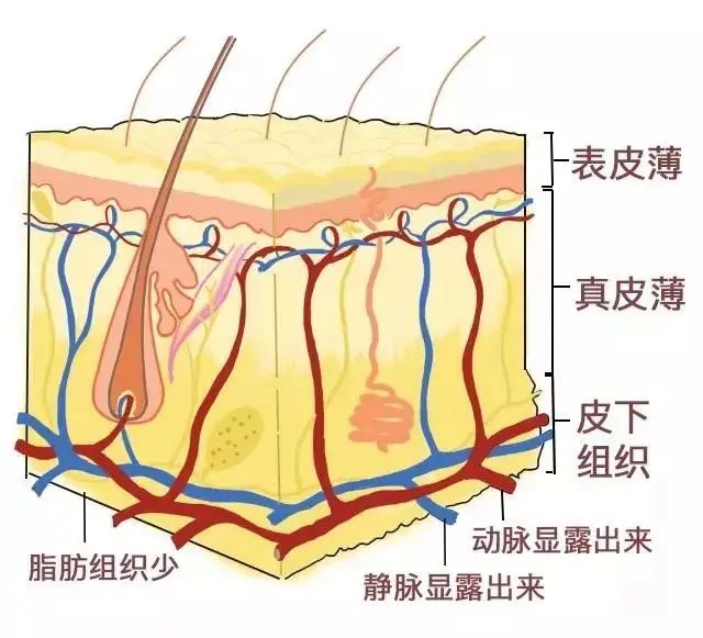 黑眼圈分几种怎么治,黑眼圈的种类和解决办法