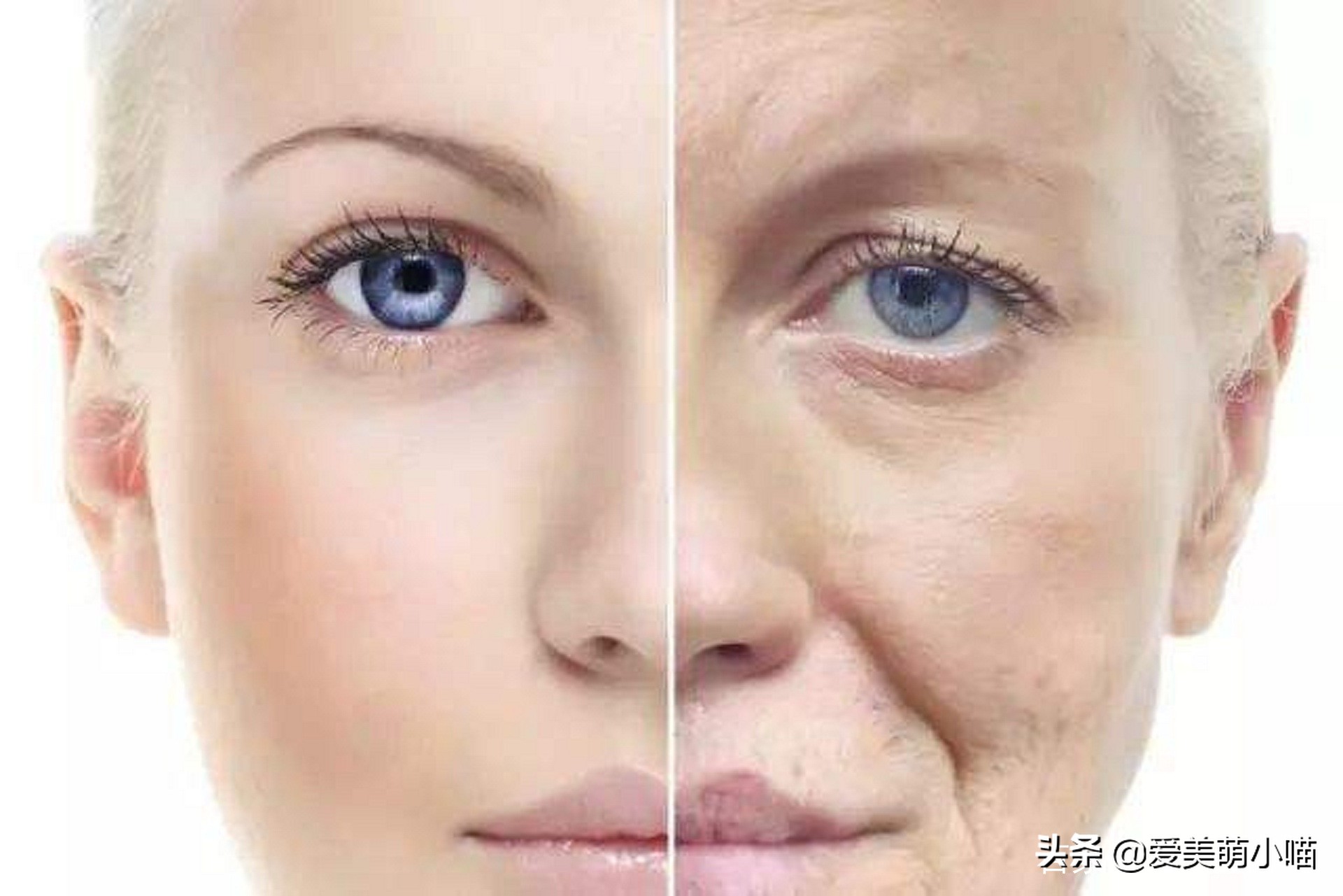 法令纹苹果肌下垂自测,脂肪型法令纹怎么自测