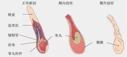 睾丸坏死被迫摘除,老人睾丸切除事件