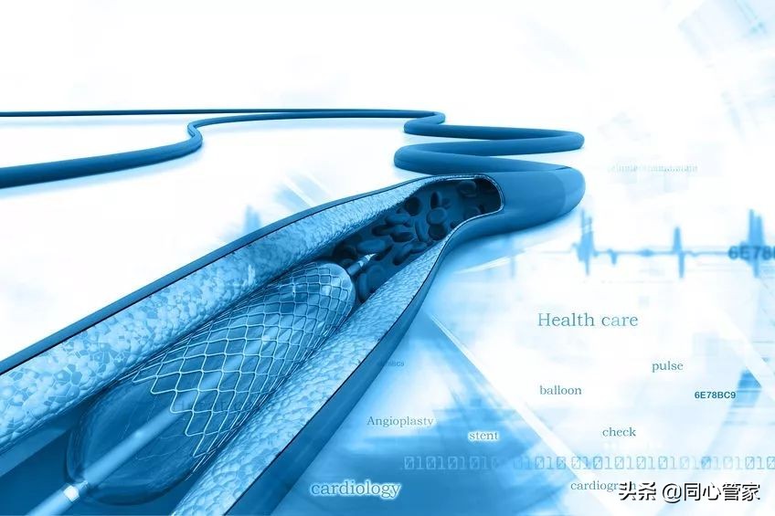 血管狭窄如何扼住生命的咽喉？让你全身器官都遭殃？
