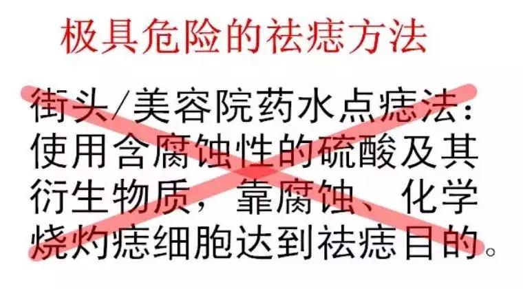 民间点痣最方便安全简单的偏方,街边的那些点痣是真的有效吗