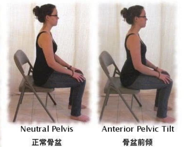 骨盆前倾引起的腰痛如何缓解,如何缓解久坐带来的腰酸腰痛