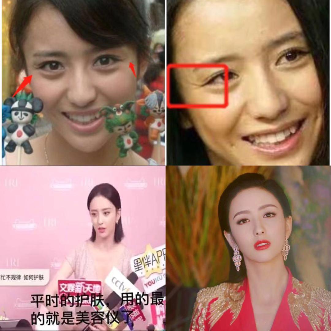 王鸥谈打了瘦脸针,王鸥打过瘦脸针吗