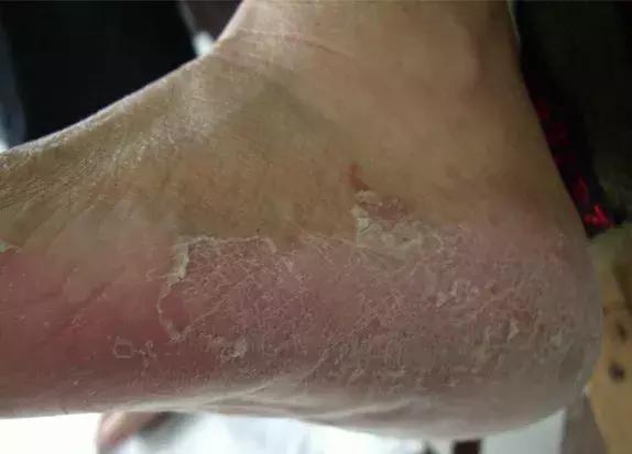 透气舒适不捂脚潮袜推荐,好穿又好搭吸汗防臭袜